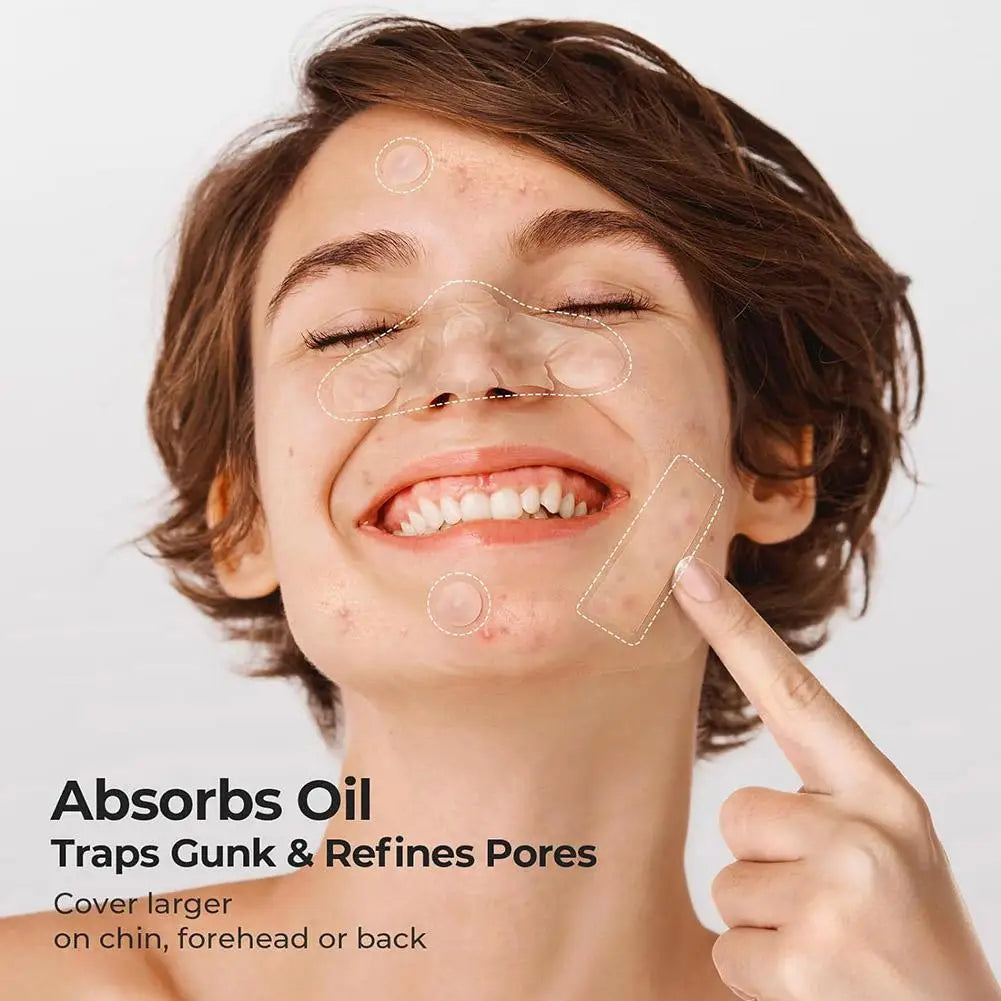 Acne Fighter Patches