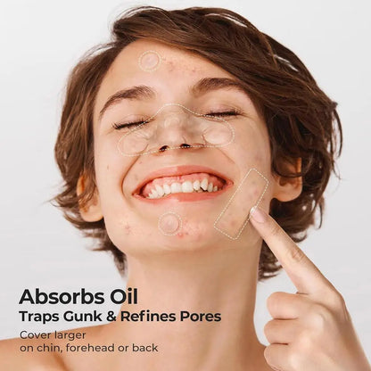 Acne Fighter Patches