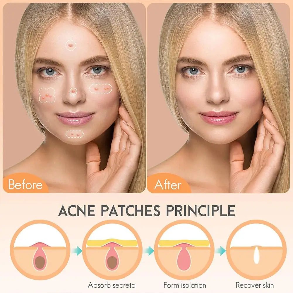 Acne Fighter Patches