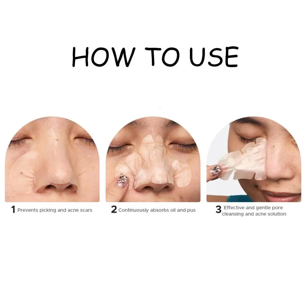 Acne Fighter Patches
