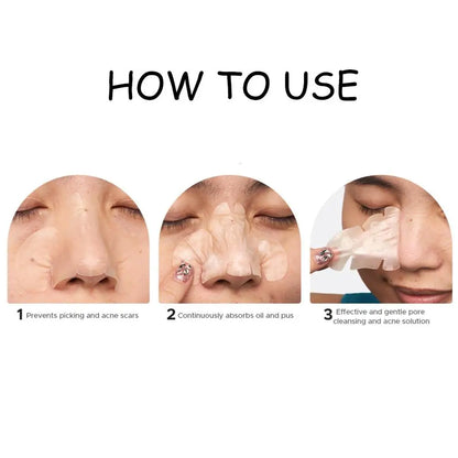 Acne Fighter Patches