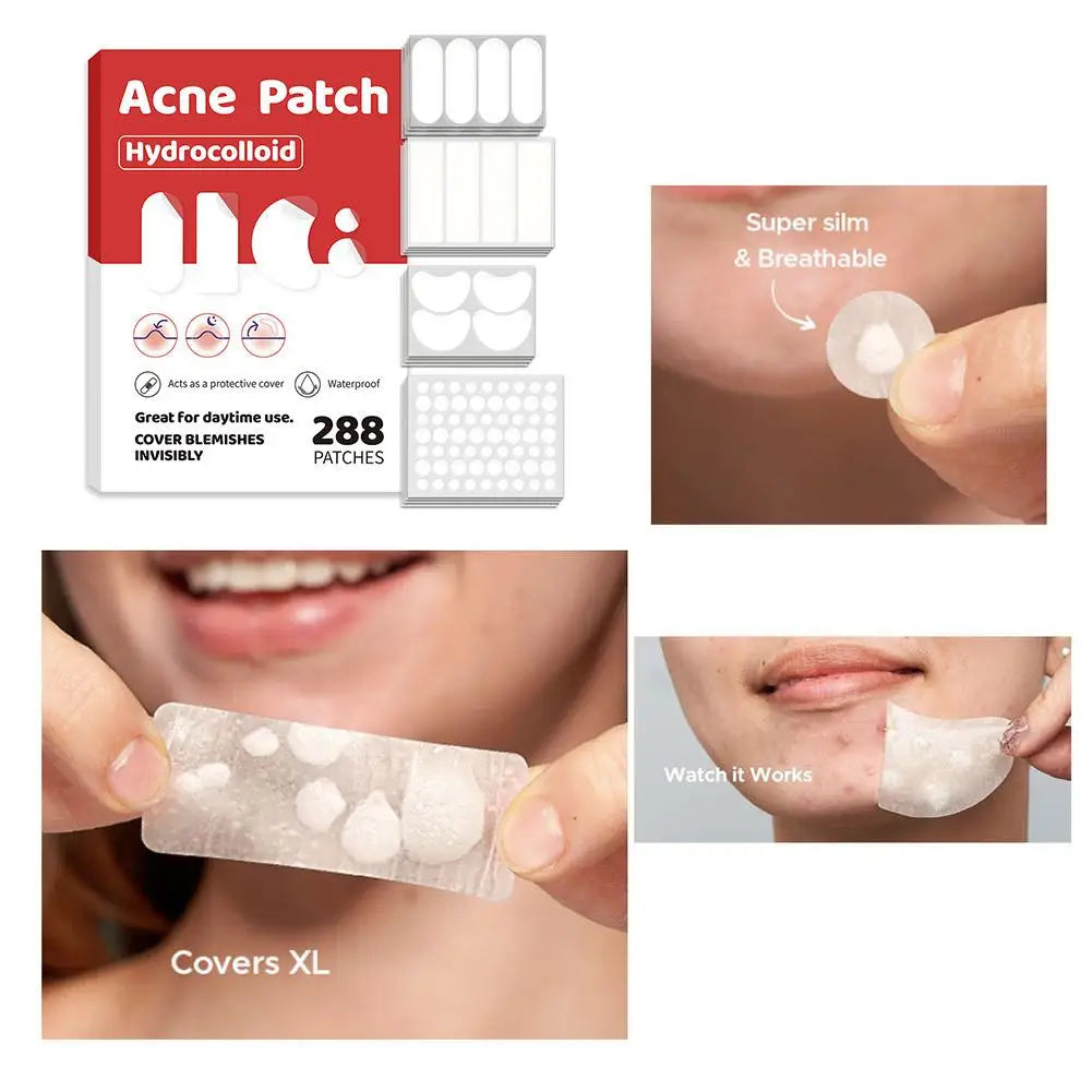Acne Fighter Patches
