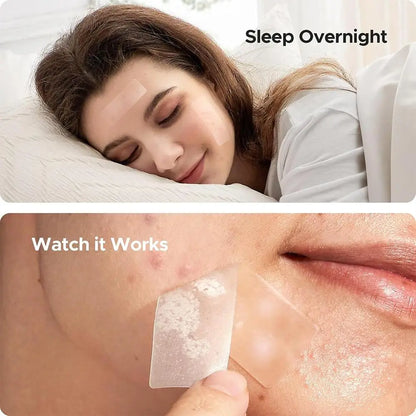 Acne Fighter Patches