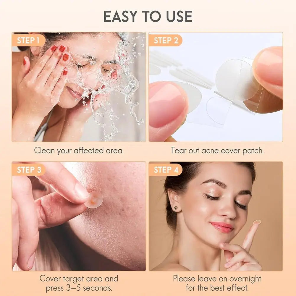Acne Fighter Patches