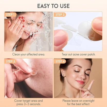 Acne Fighter Patches