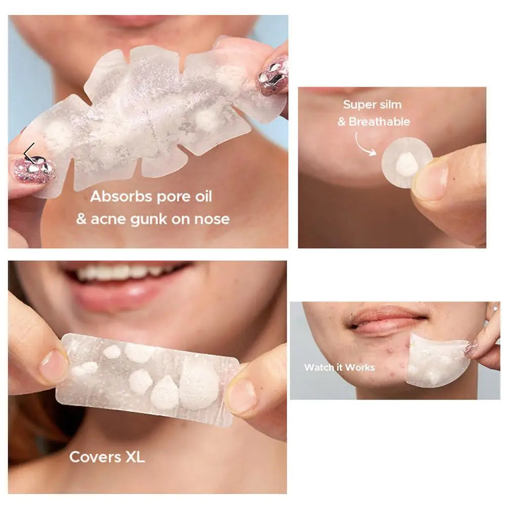Acne Fighter Patches