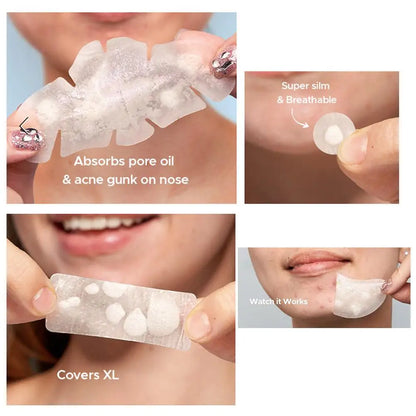 Acne Fighter Patches