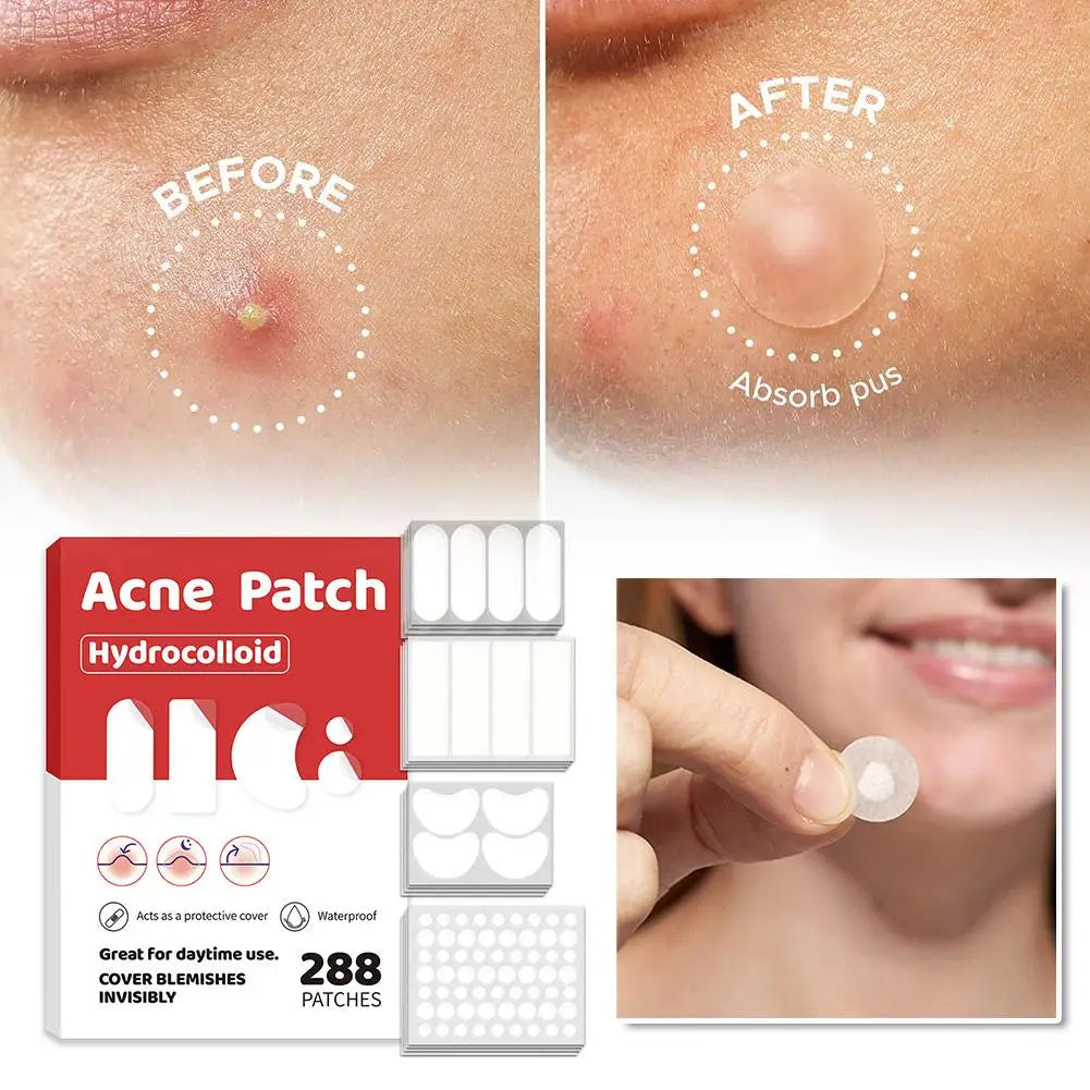 Acne Fighter Patches