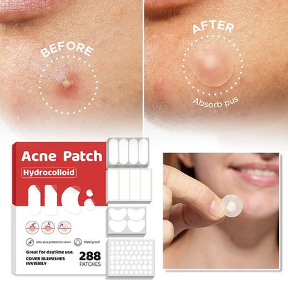 Acne Fighter Patches